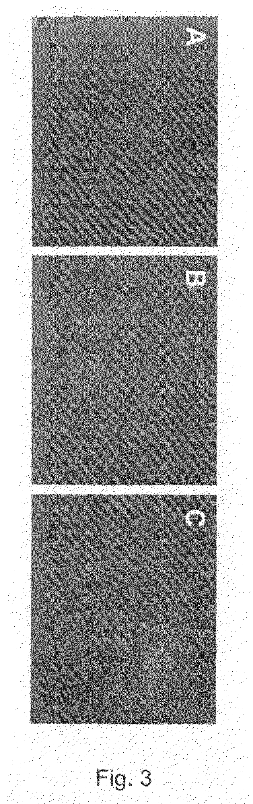 Population of multipotent cardiac precursor cells derived from human blastocysts derived stem cells