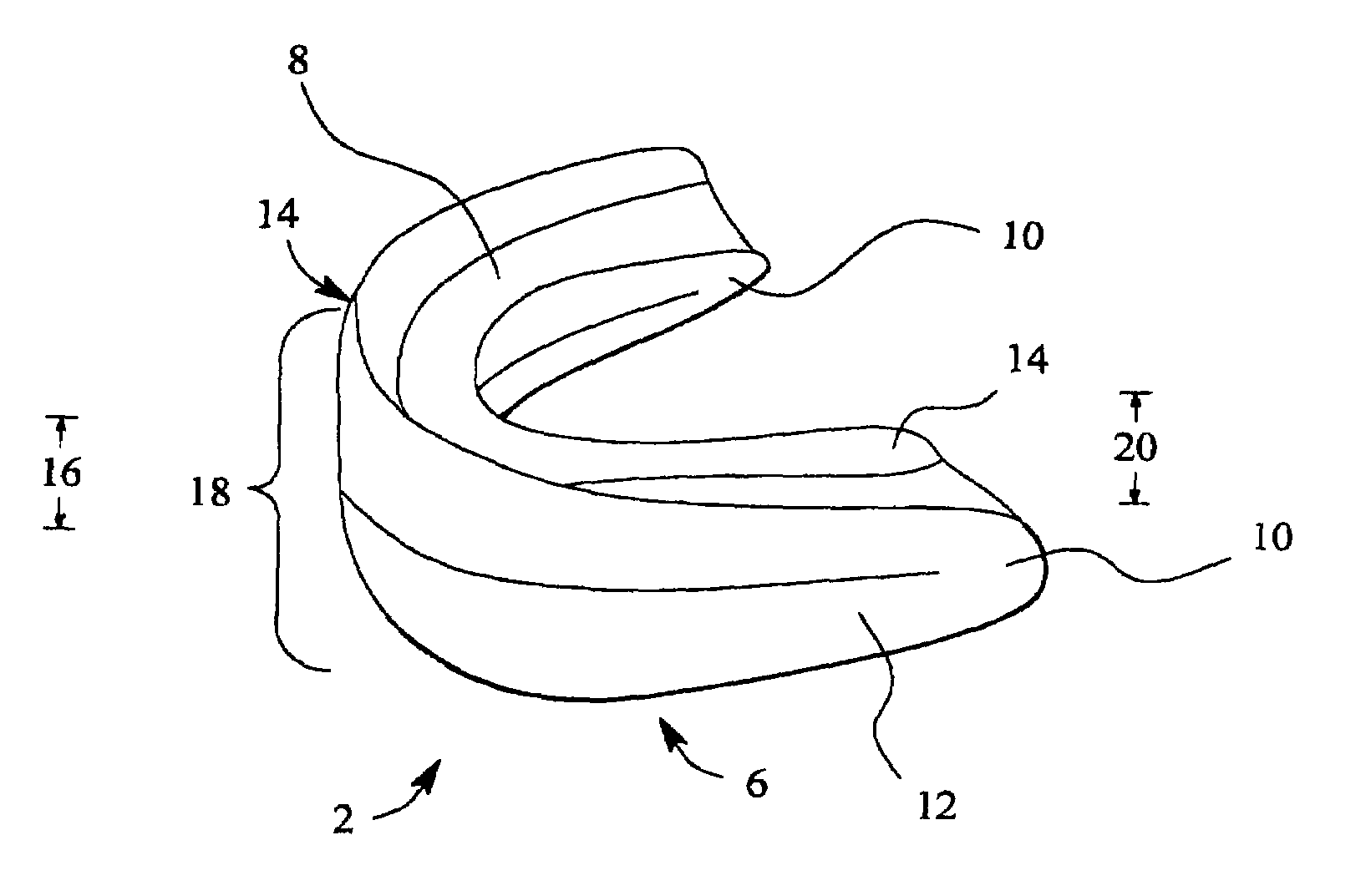 Dental appliance having an altered vertical thickness between an upper shell and a lower shell with an integrated hinging mechanism to attach an upper shell and a lower shell and a system and a method for treating malocclusions
