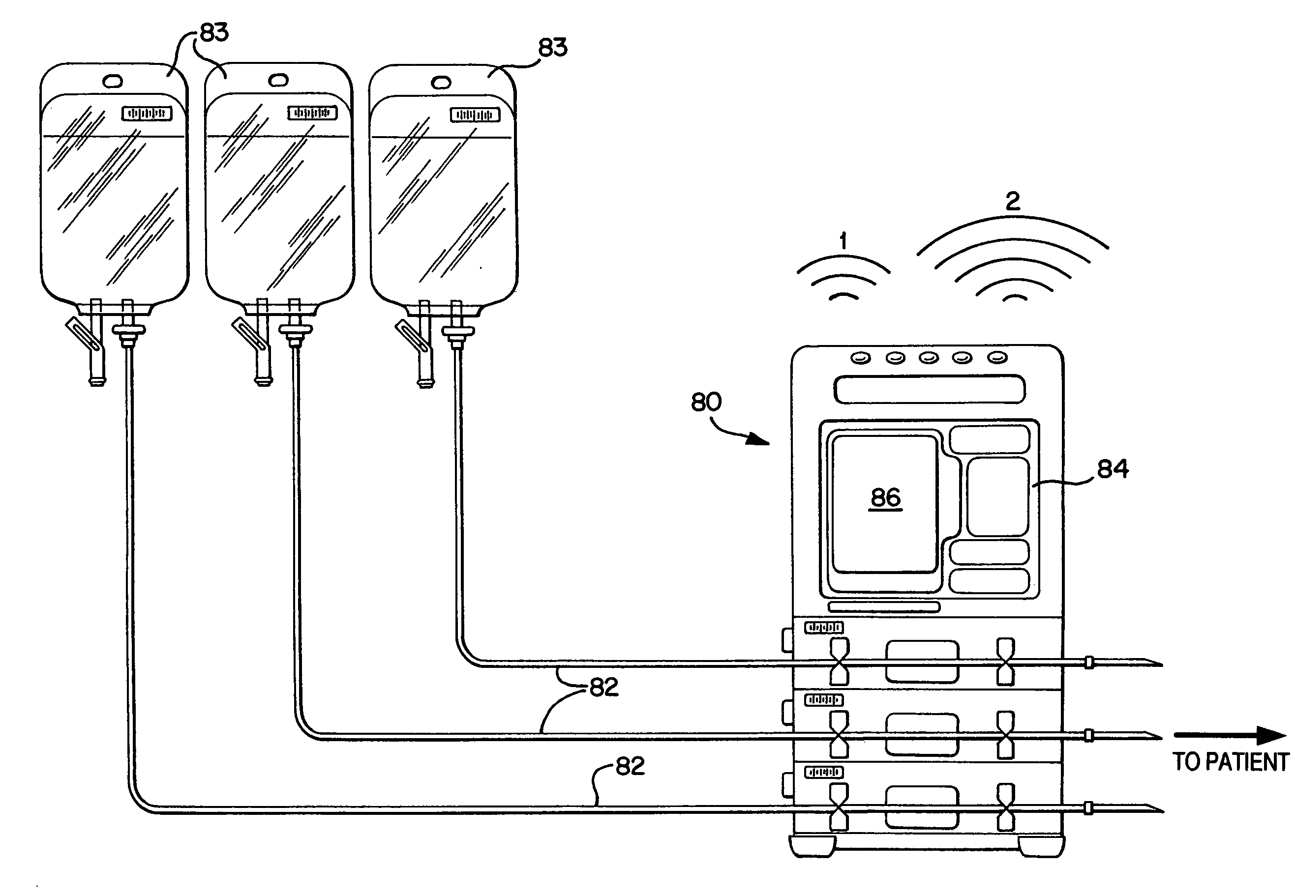 Multi-state alarm system for a medical pump