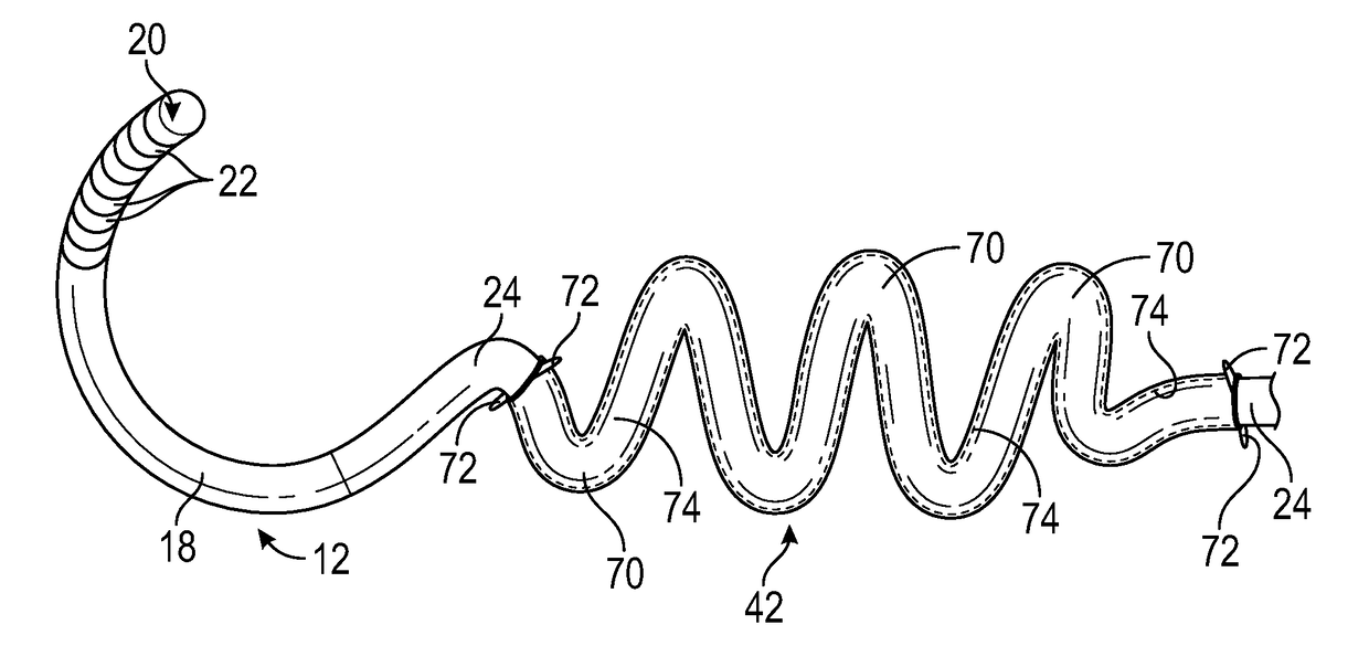 Adjustable length tension sleeve for electrical or thermal stimulation device