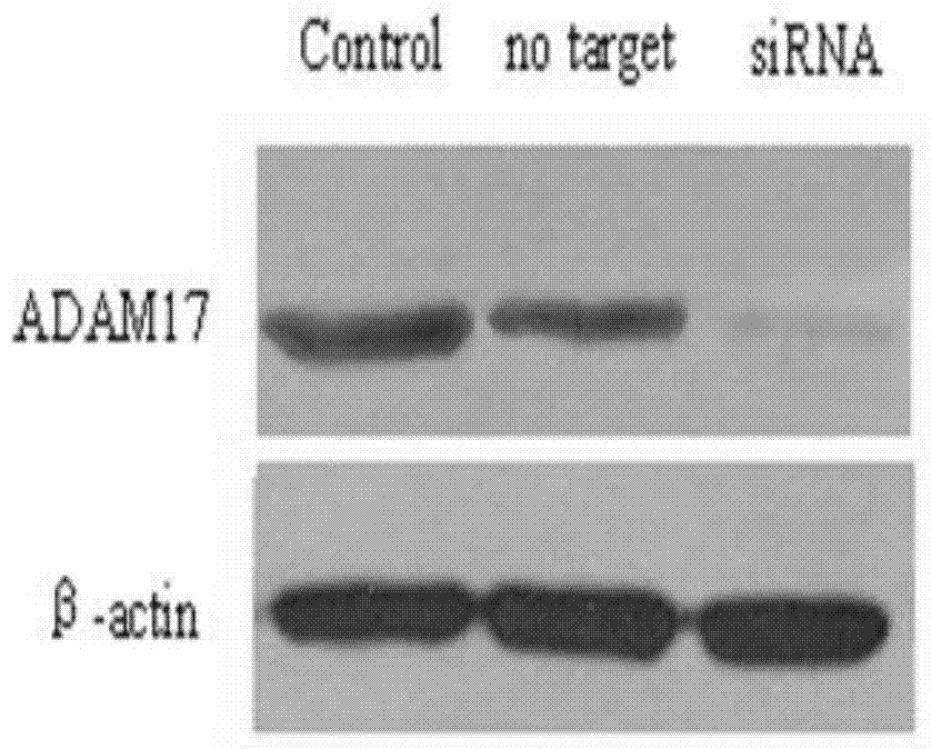 siRNA for inhibiting ADAM17 (a disintegrin and metalloprotease 17) genes and application of siRNA
