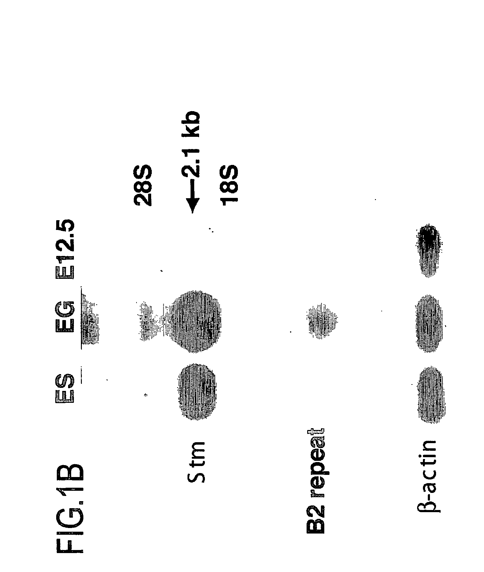 Marker for undifferentiated state of cell and composition and method for separation and preparation of stem cells