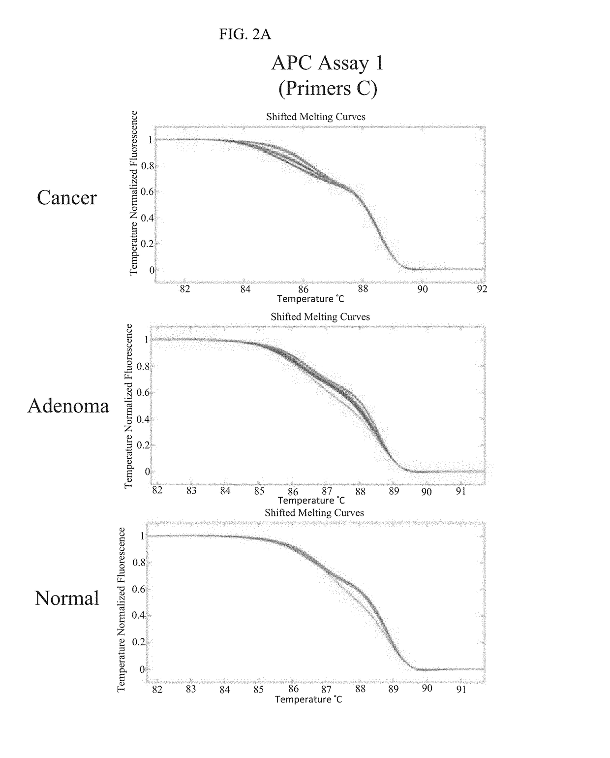 Methods and materials for detecting colorectal cancer and adenoma