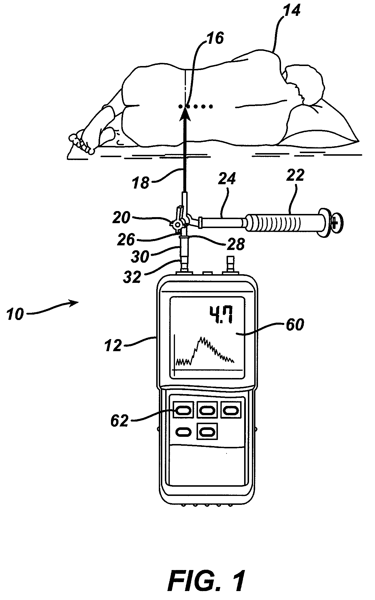 System and Method for Measuring the Pressure of a Fluid System Within a Patient