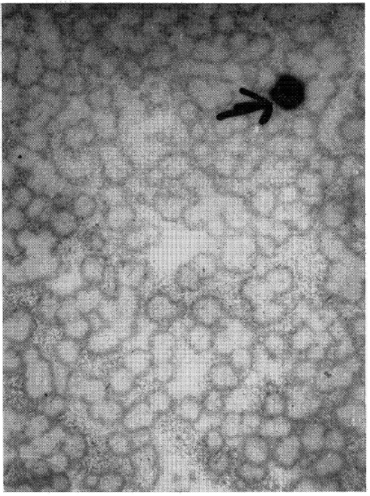 Isolated nucleic acid molecules which encode a melanoma specific antigen and uses thereof