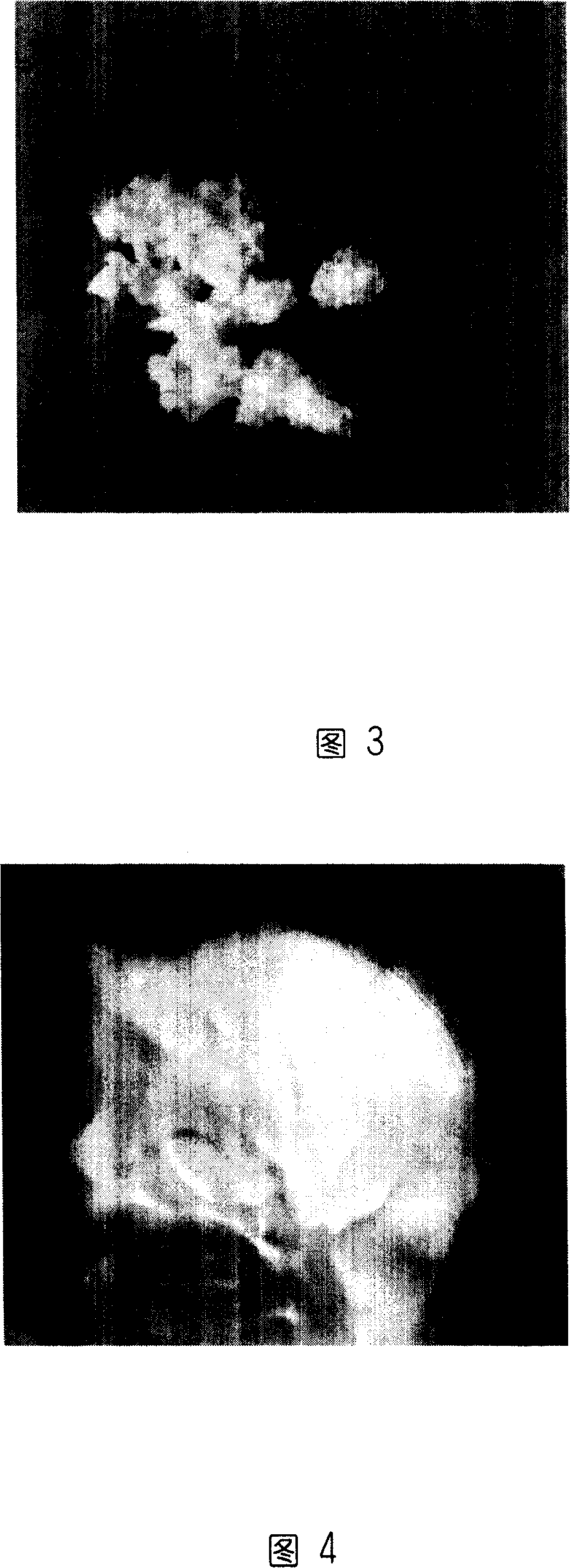 Babies' formula milk powder restructured composition of protein and producing method thereof