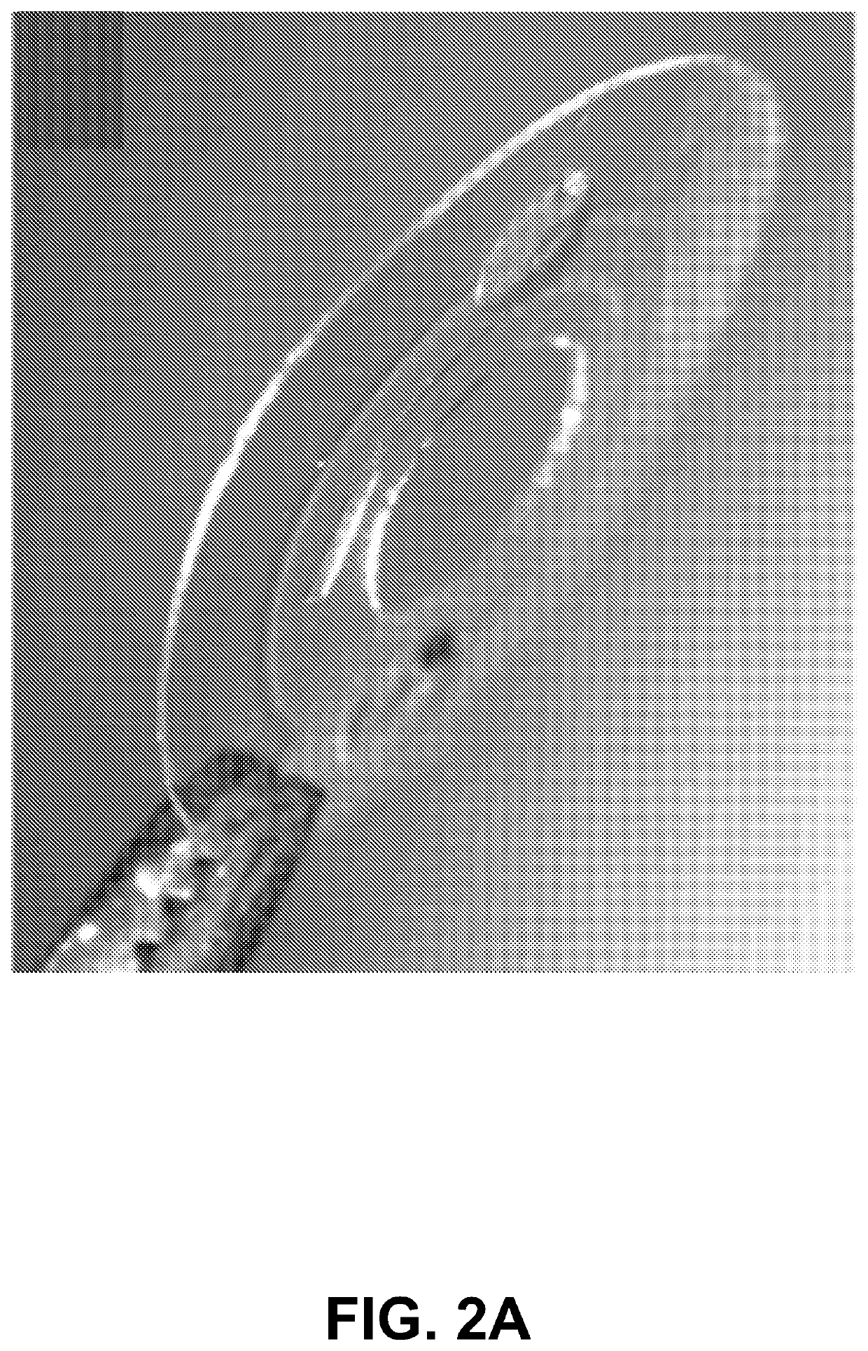 Closed microfluidic network for strain sensing embedded in a contact lens to monitor intraocular pressure