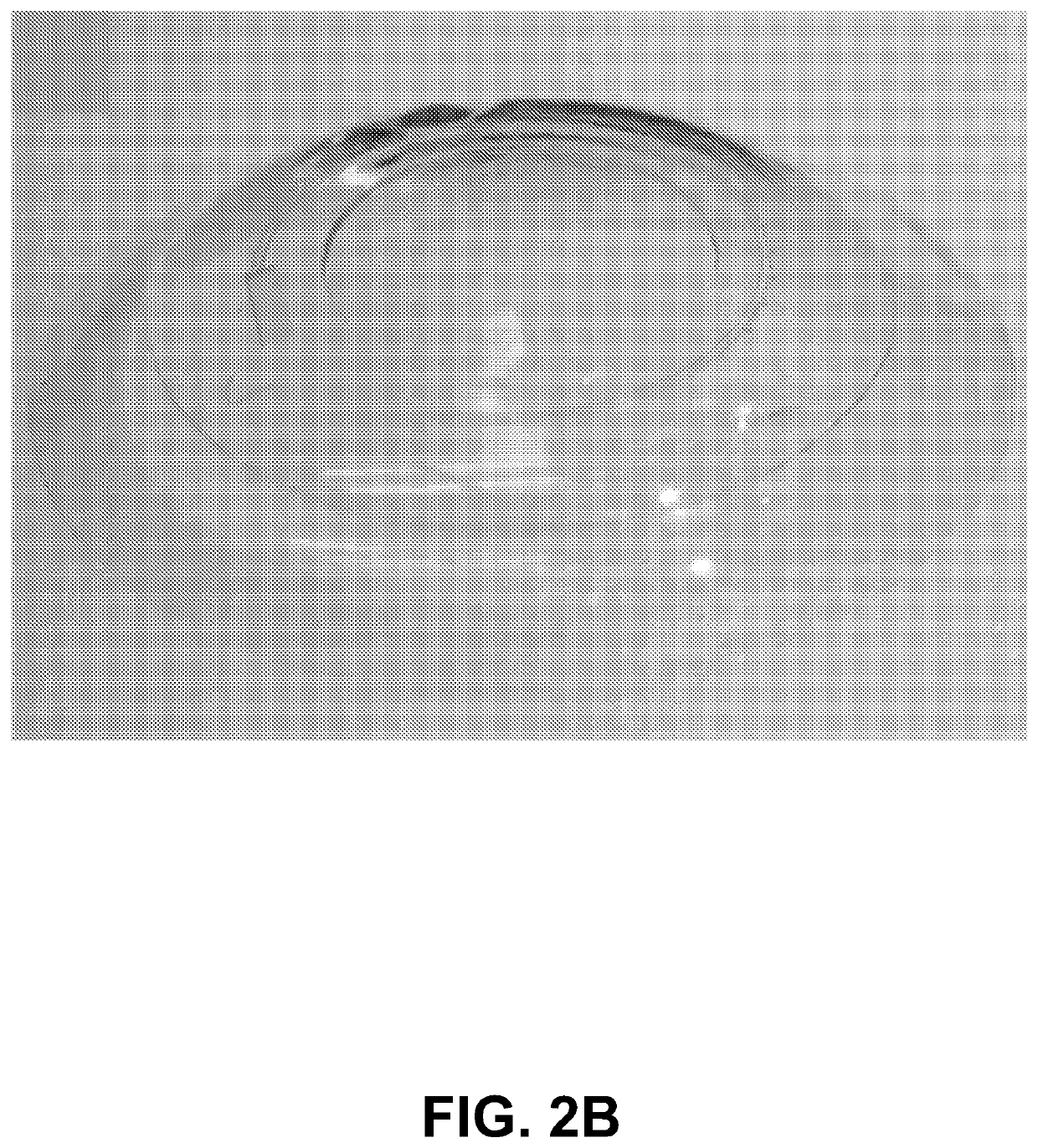 Closed microfluidic network for strain sensing embedded in a contact lens to monitor intraocular pressure