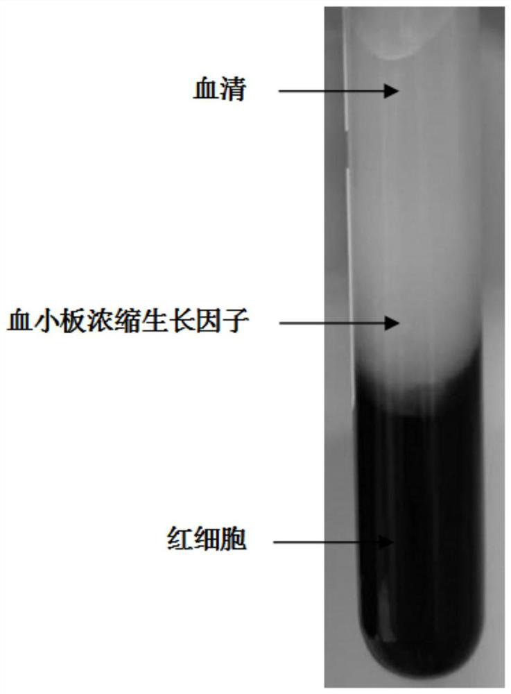 Stem cell preparation for beautifying and resisting aging as well as preparation method and application of stem cell preparation