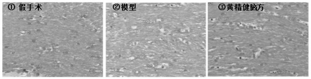 A traditional Chinese medicine composition for treating leukoencephalopathy and its application