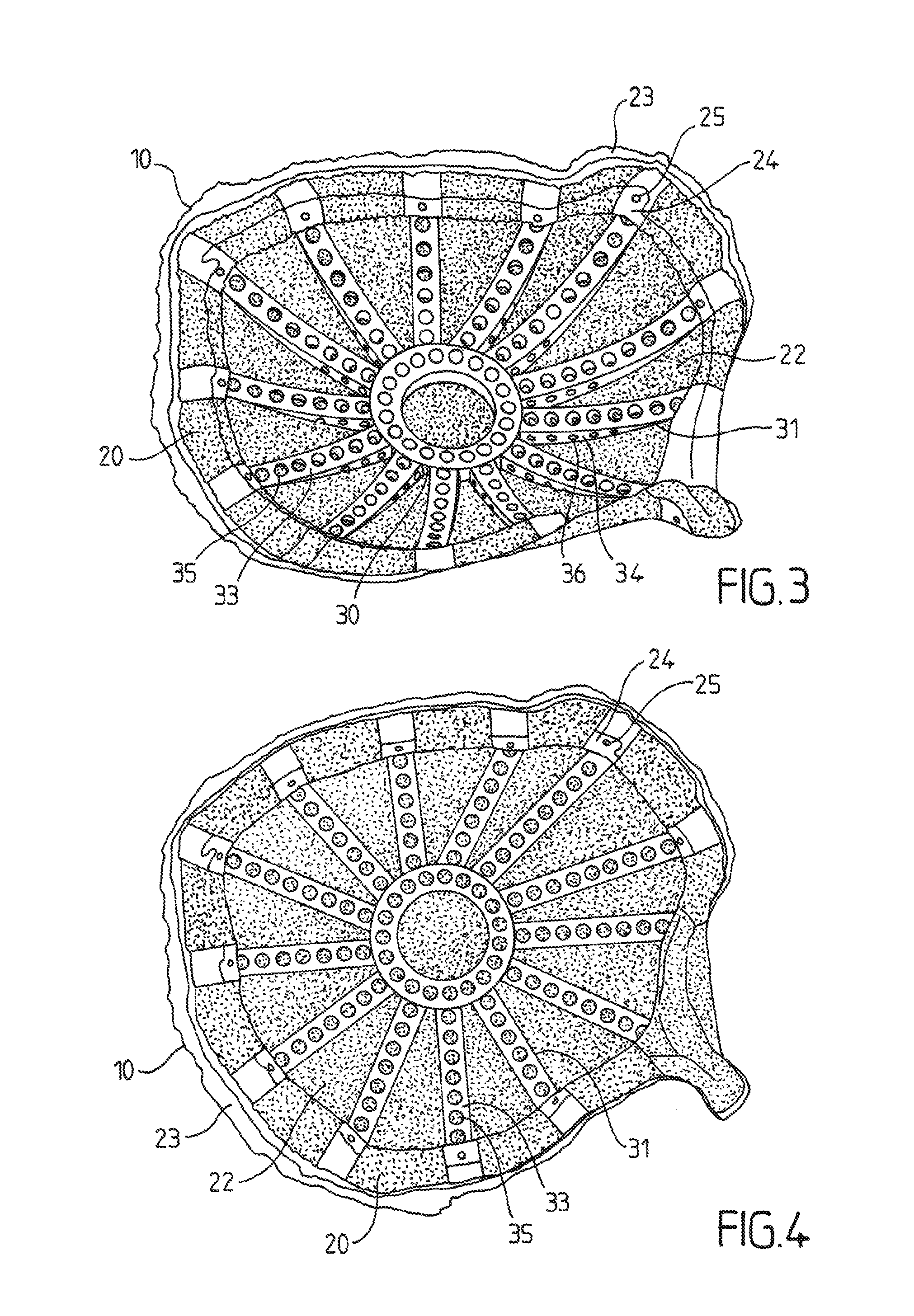 Reinforced biocompatible ceramic implant and manufacturing method thereof