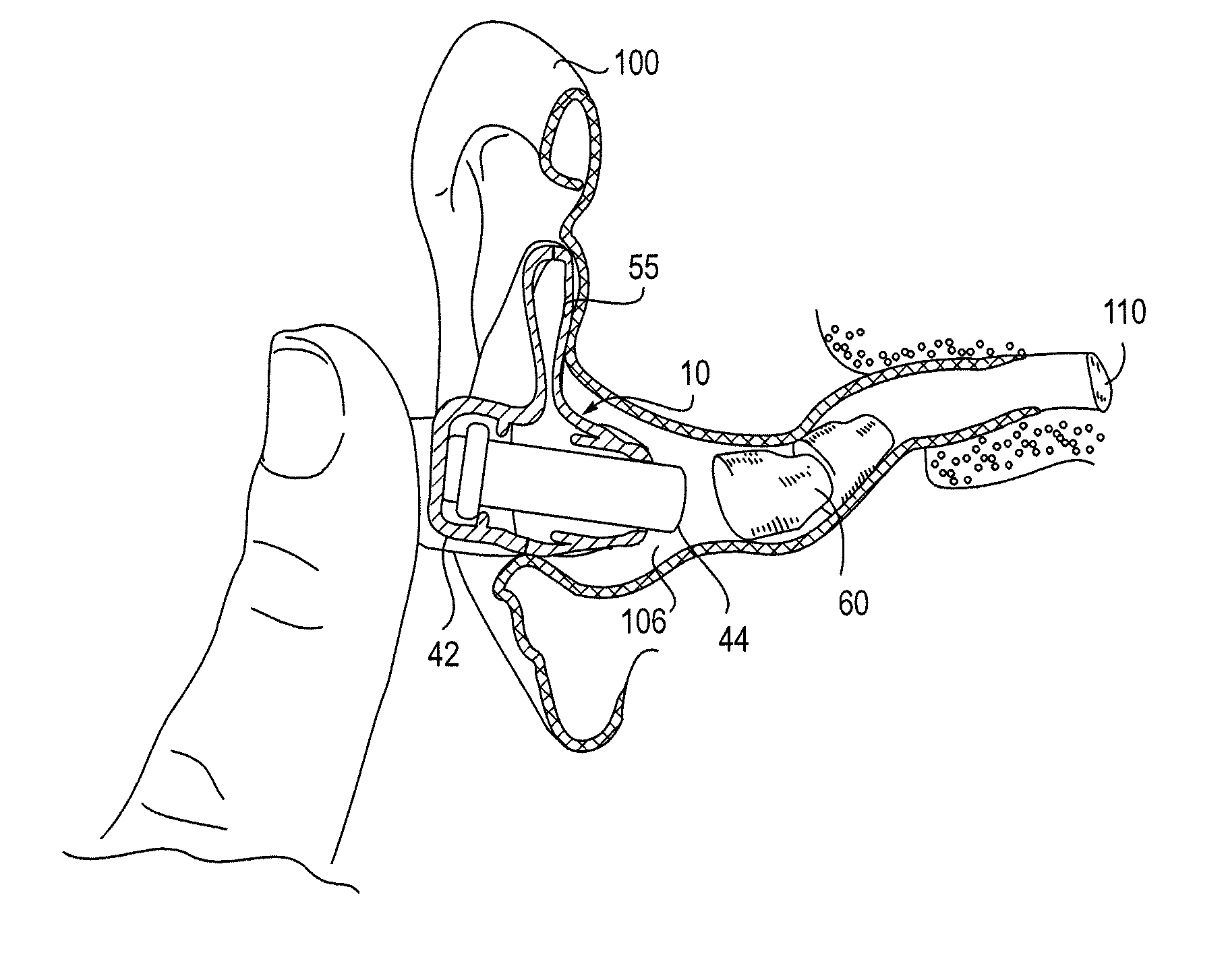 Insertion device for deep-in-the-canal hearing devices