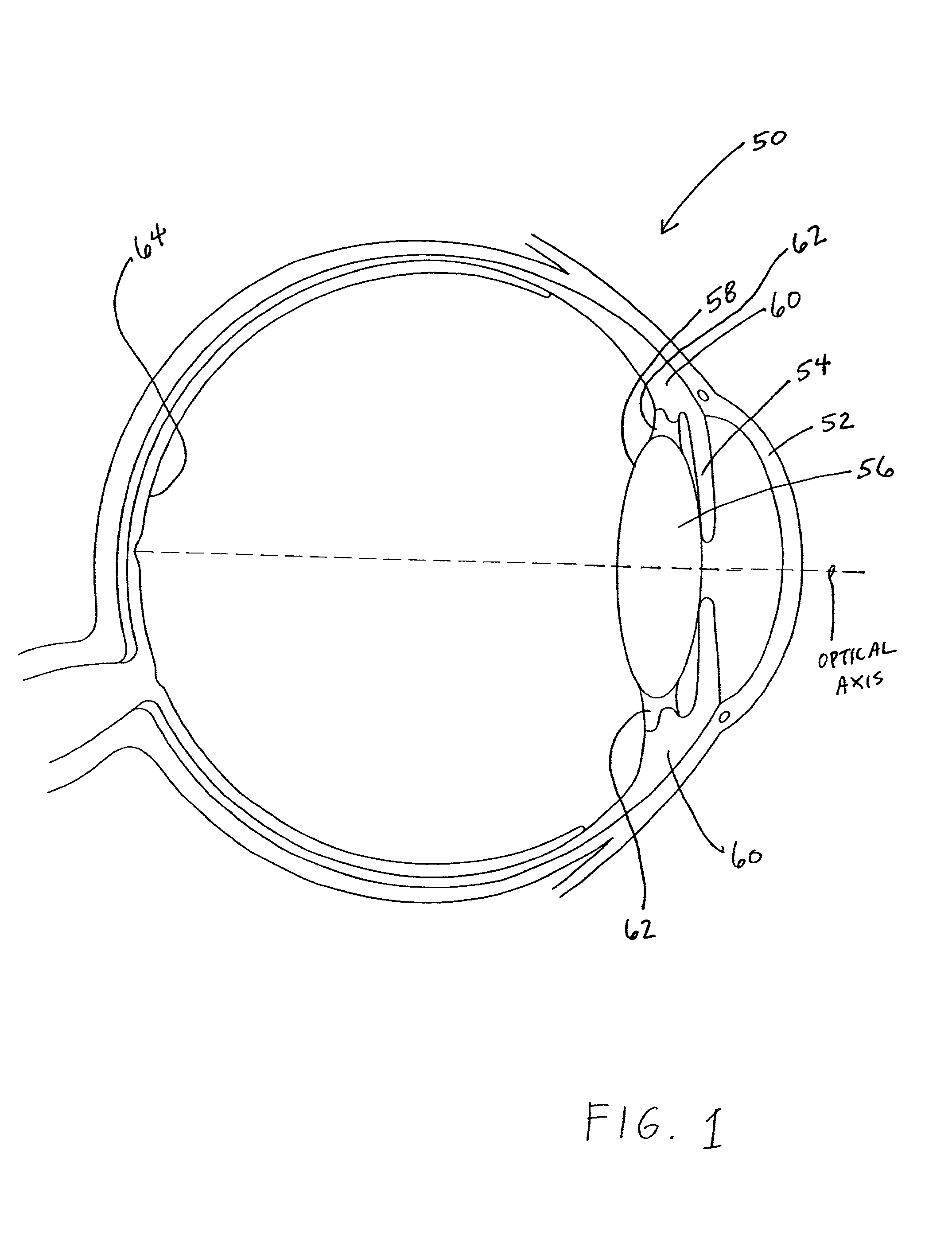 Connection geometry for intraocular lens system