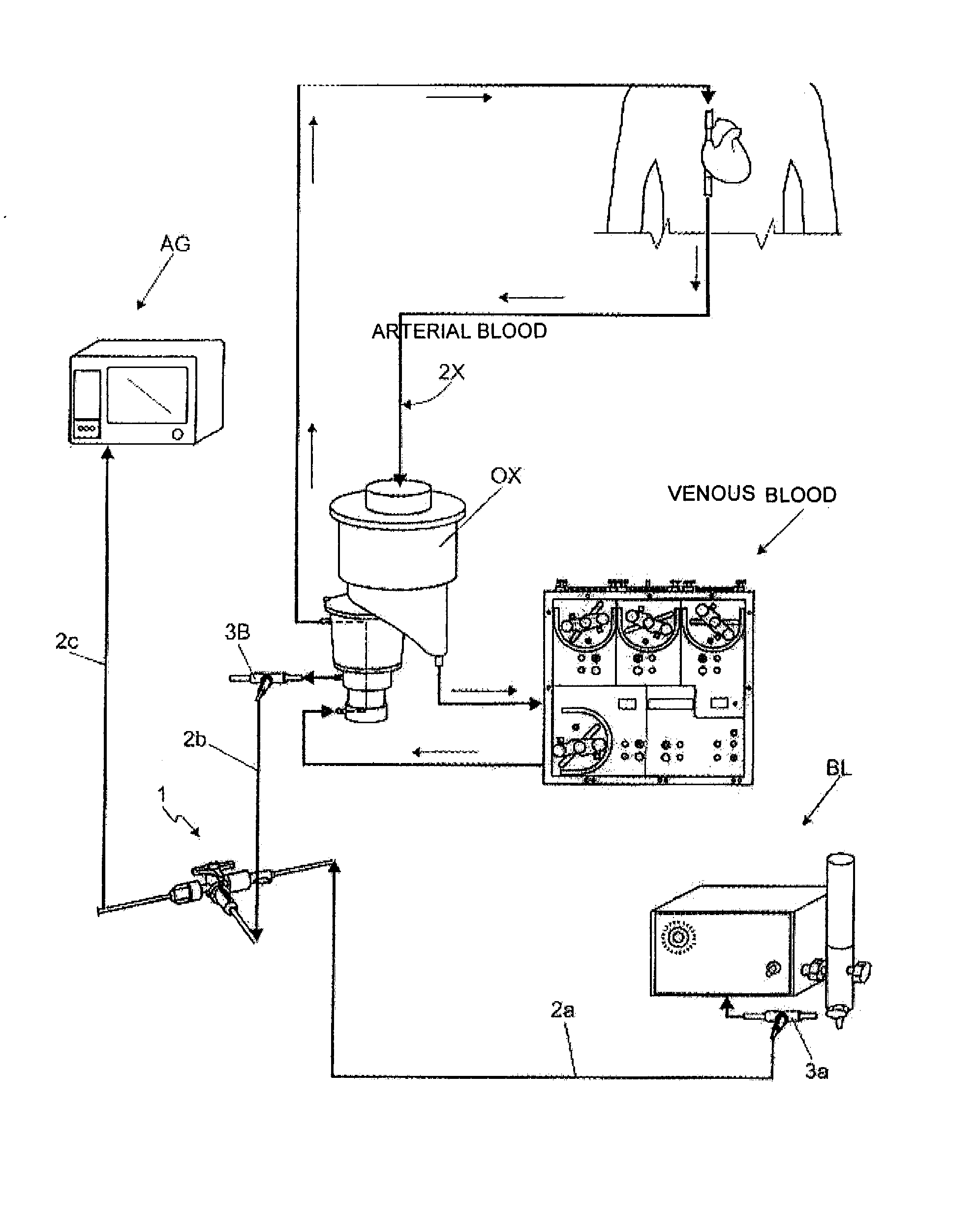 Oximetry and capnography system applied to extracorporeal circulation - ecc - procedure