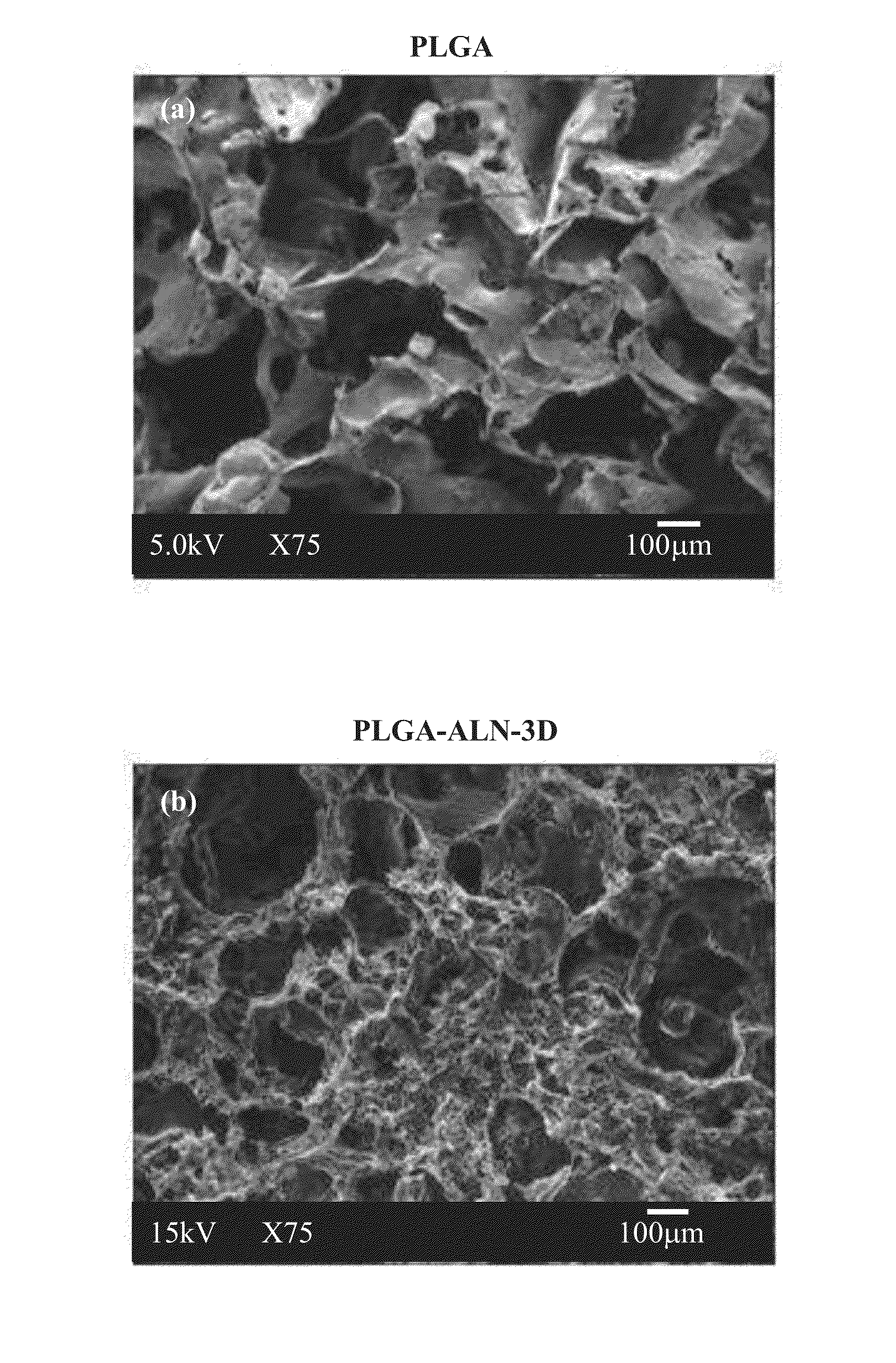 Method for bone formation by administering poly(lactic-co-glycolic acid) cross-linked alendronate