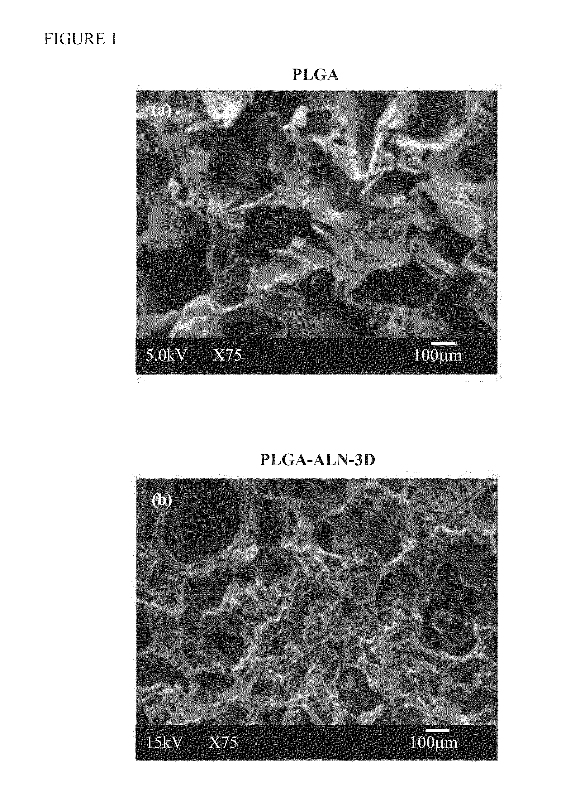 Method for bone formation by administering poly(lactic-co-glycolic acid) cross-linked alendronate