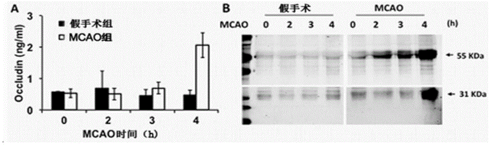 Serum marker capable of evaluating cerebral hemorrhage risk before thrombolysis and application thereof