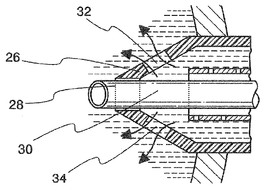 Infusion sleeve with distendable port