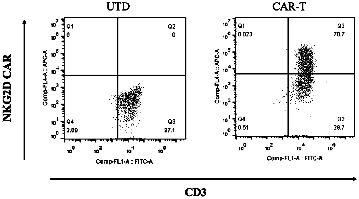 Chimeric antigen receptor targeting NKG2D, chimeric antigen receptor T-cell targeting NKG2D and preparation method thereof and application thereof