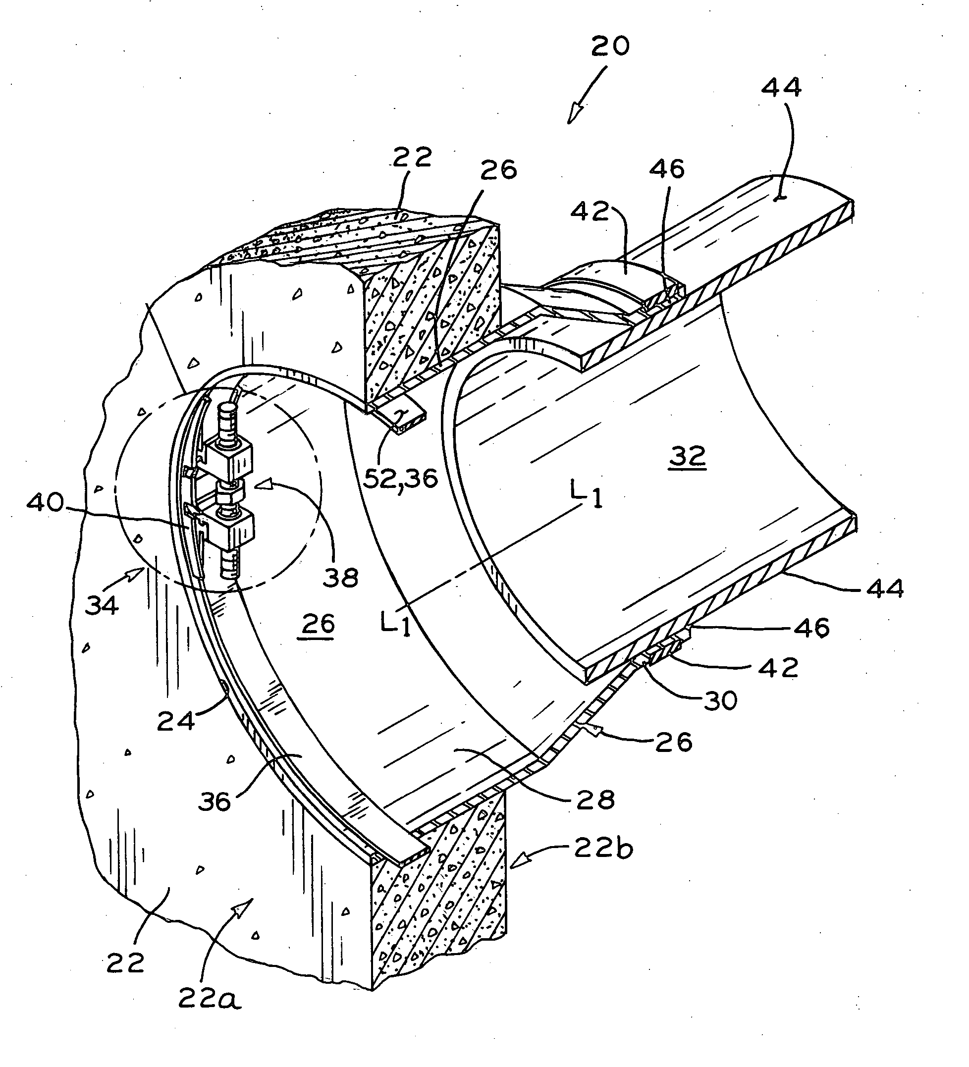 Expansion ring assembly with removable drive mechanism