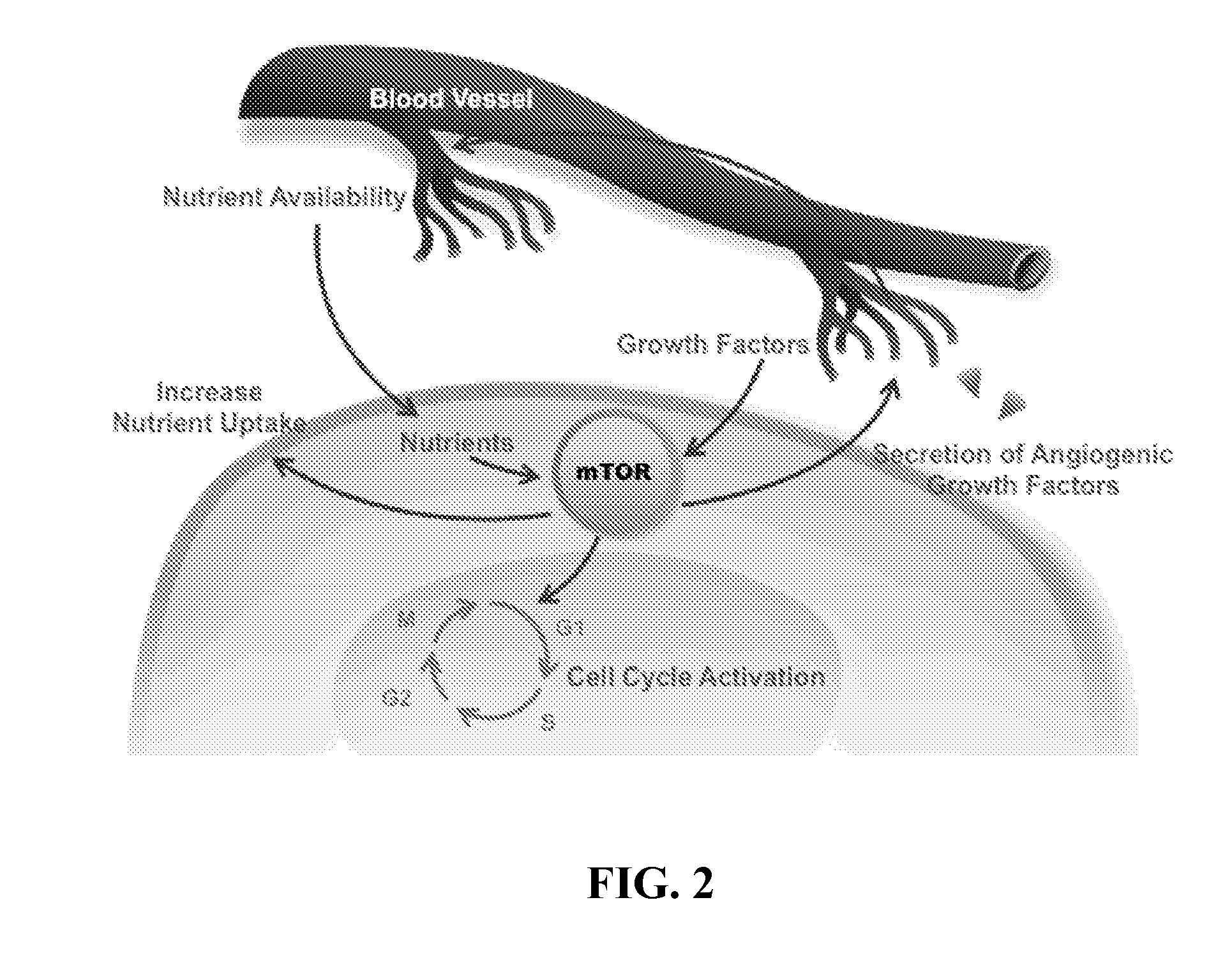 Methods and compositions for treatment of ophthalmic conditions