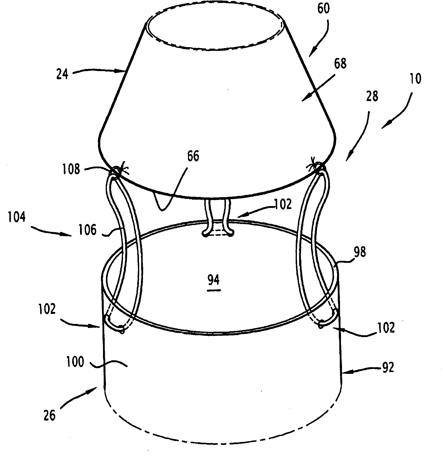 Device for treating a blood circulation conduit