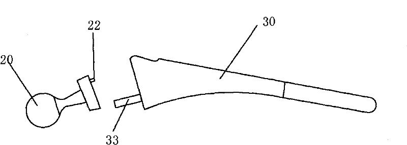 Prosthesis registering device