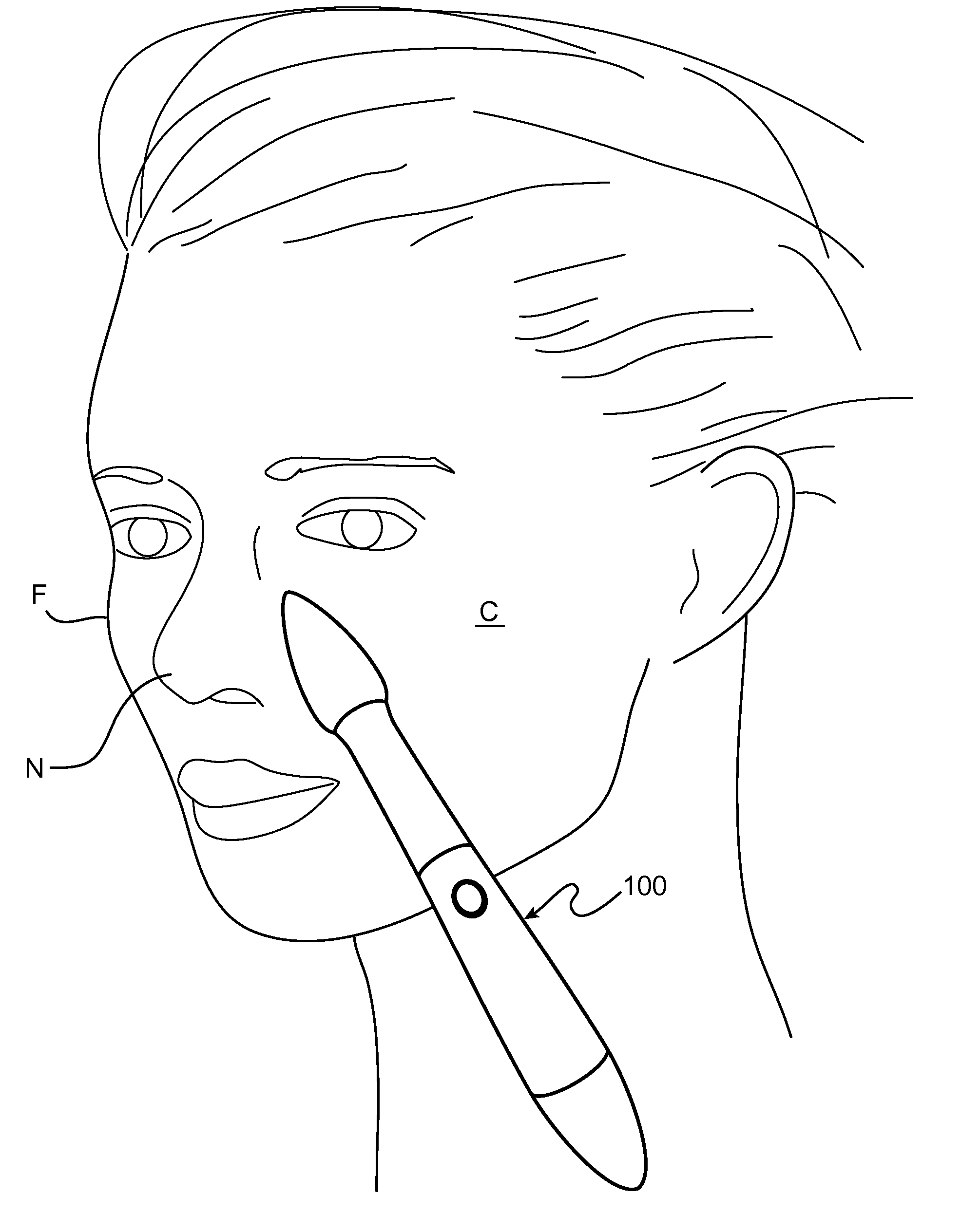 Skin treatment device