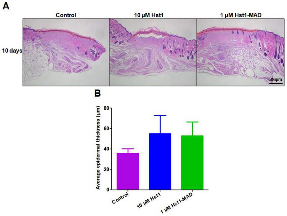 Application of polypeptide in preparation of product for promoting skin wound healing