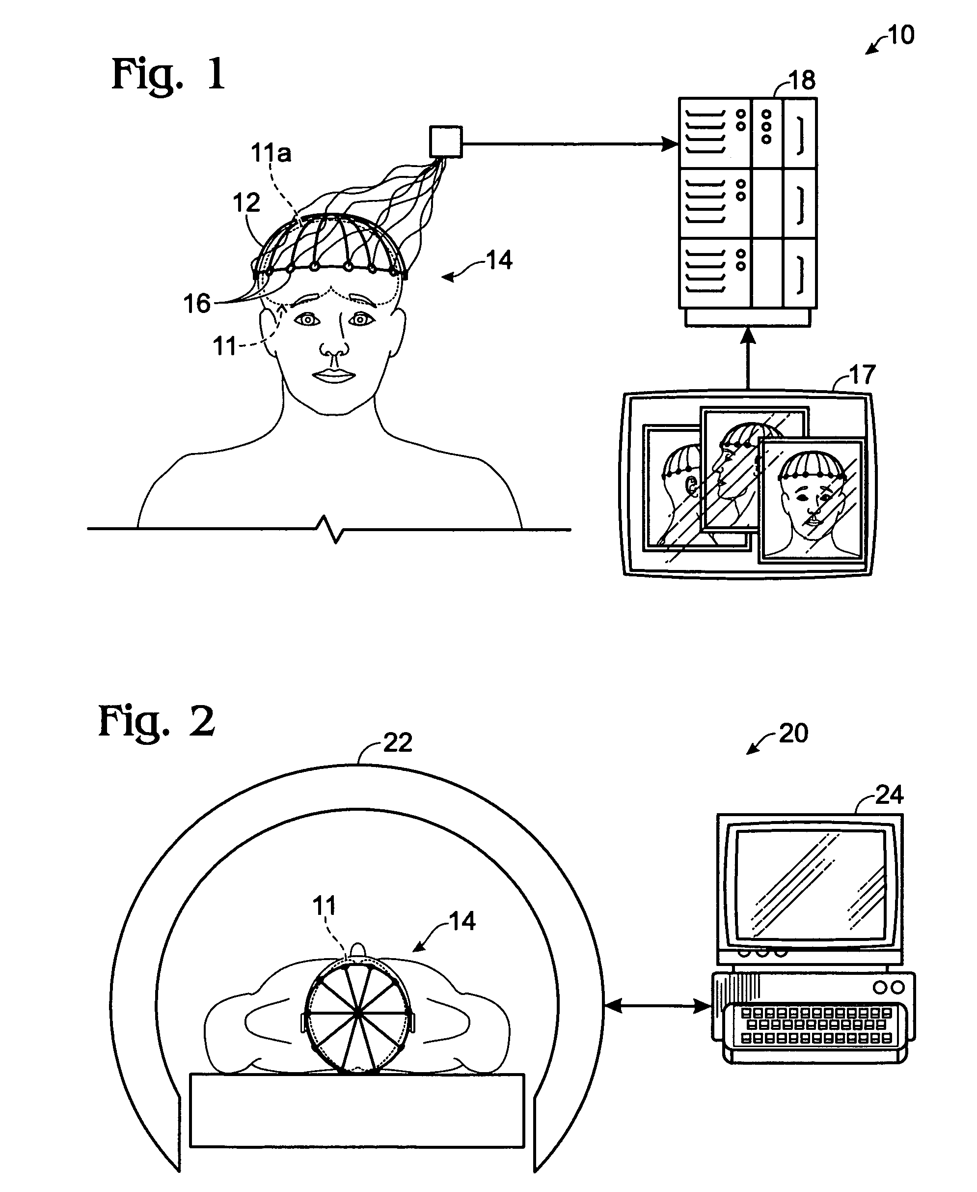 Method for locating tracts of electrical brain activity