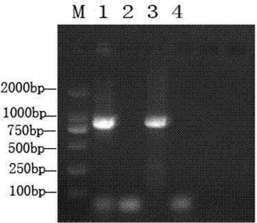 RT-PCR (Reverse Transcription-Polymerase Chain Reaction) primer for detecting porcine Kobu virus and kit