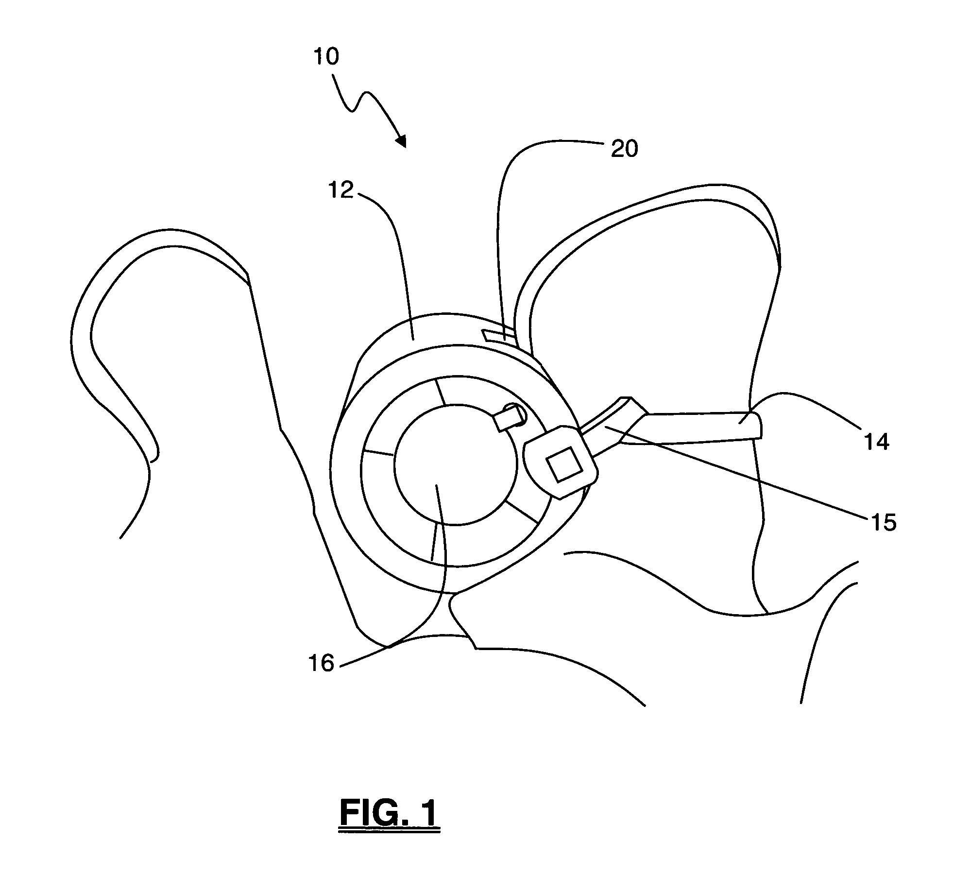 Methods and apparatus for treating spinal stenosis