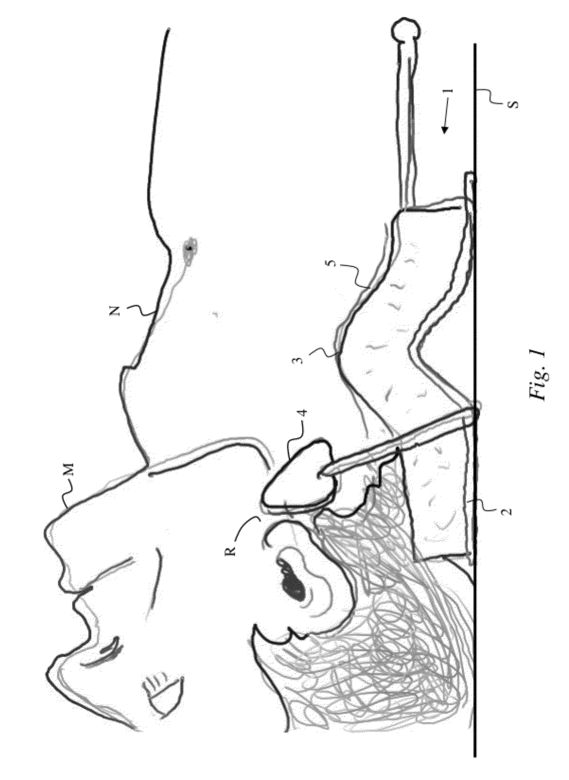 Jaw thrust device and method