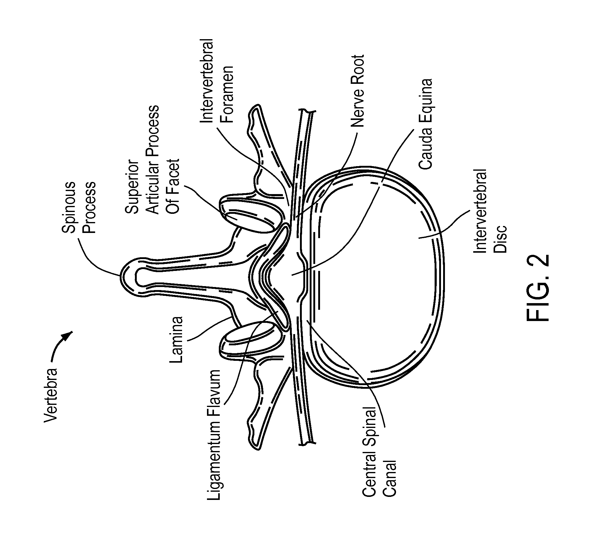 Access and tissue modification systems and methods