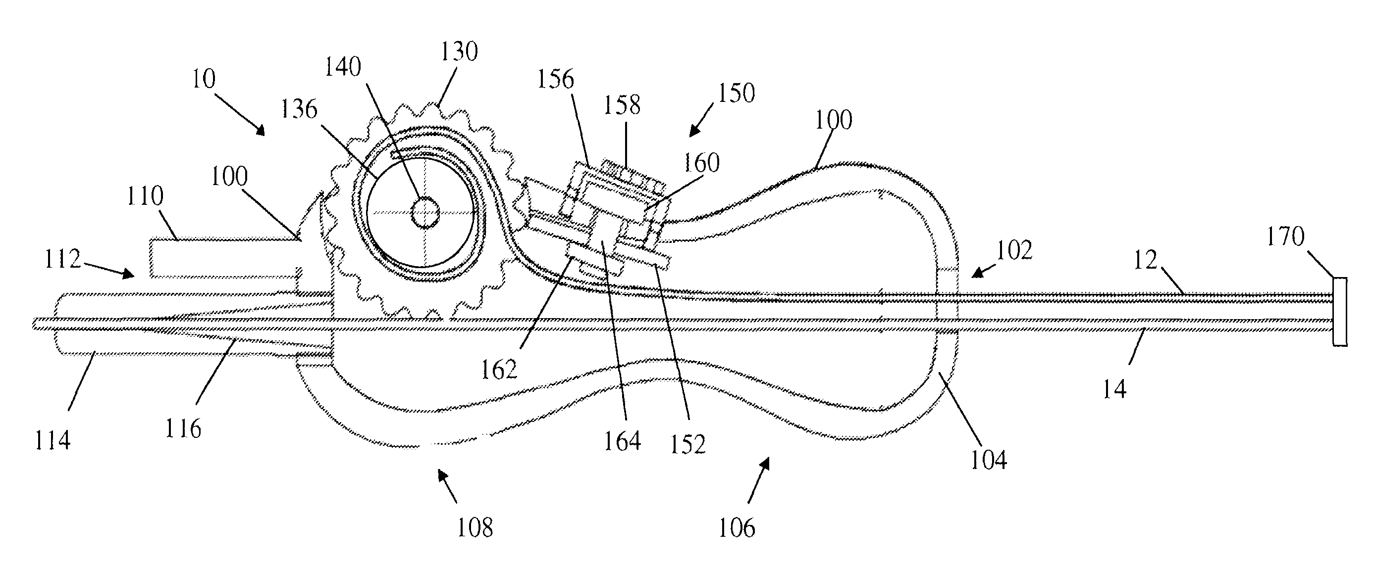 Ultrasound assisted catheter placement system