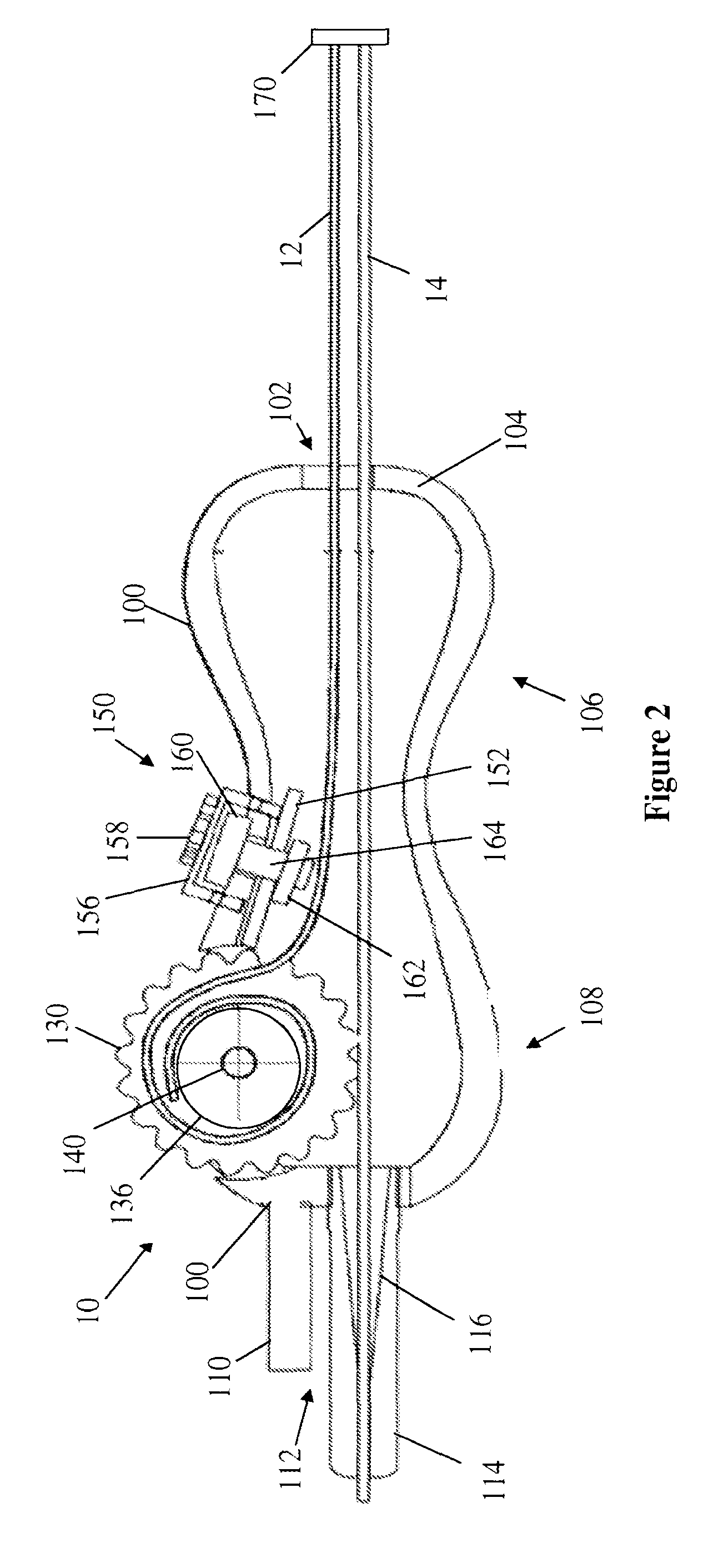 Ultrasound assisted catheter placement system