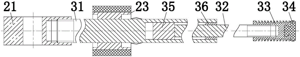 Powdery foreign body cleaning device of ear wall nursing device