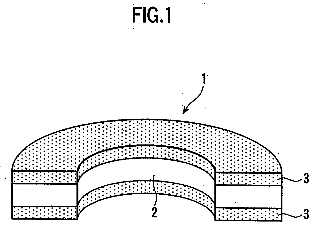 Preform structure and method of manufacturing preform and bearing housing structure having the preform formed into metal matrix composite of cylinder block