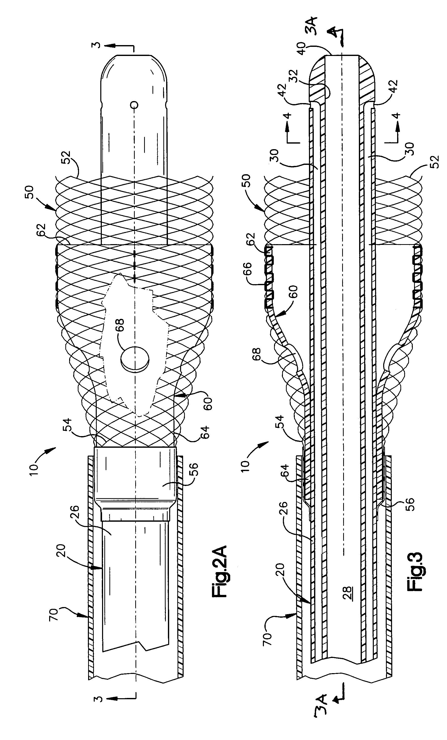 Apparatus and method for auto-retroperfusion of a coronary vein