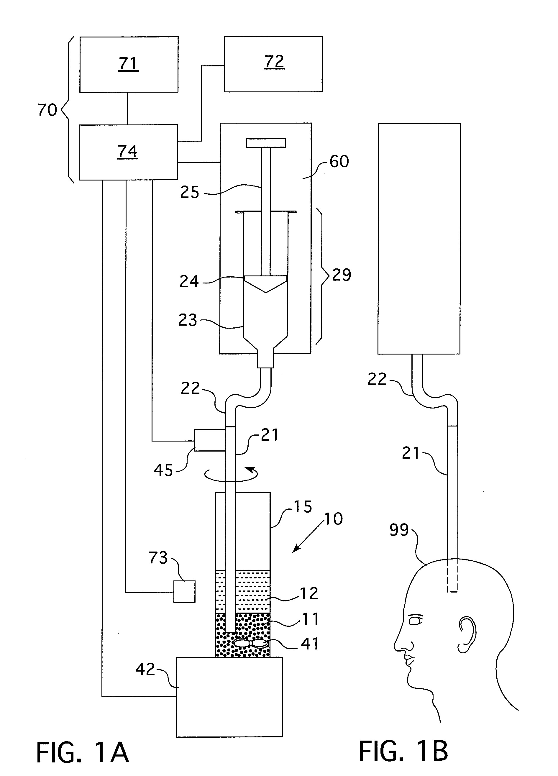 Systems and methods of delivering a dilated slurry to a patient