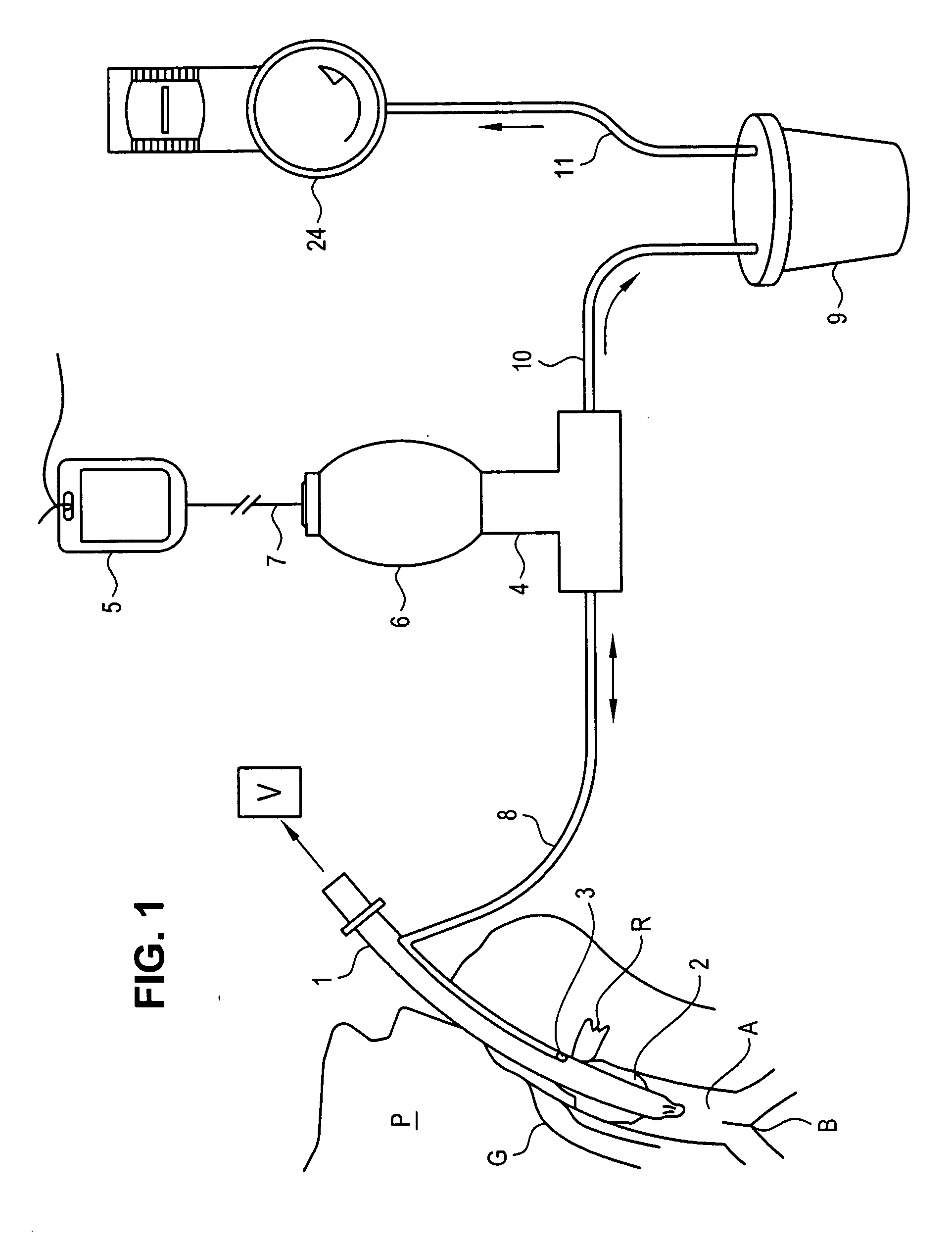 Apparatus for vacuum-assisted irrigation and drainage of a body cavity