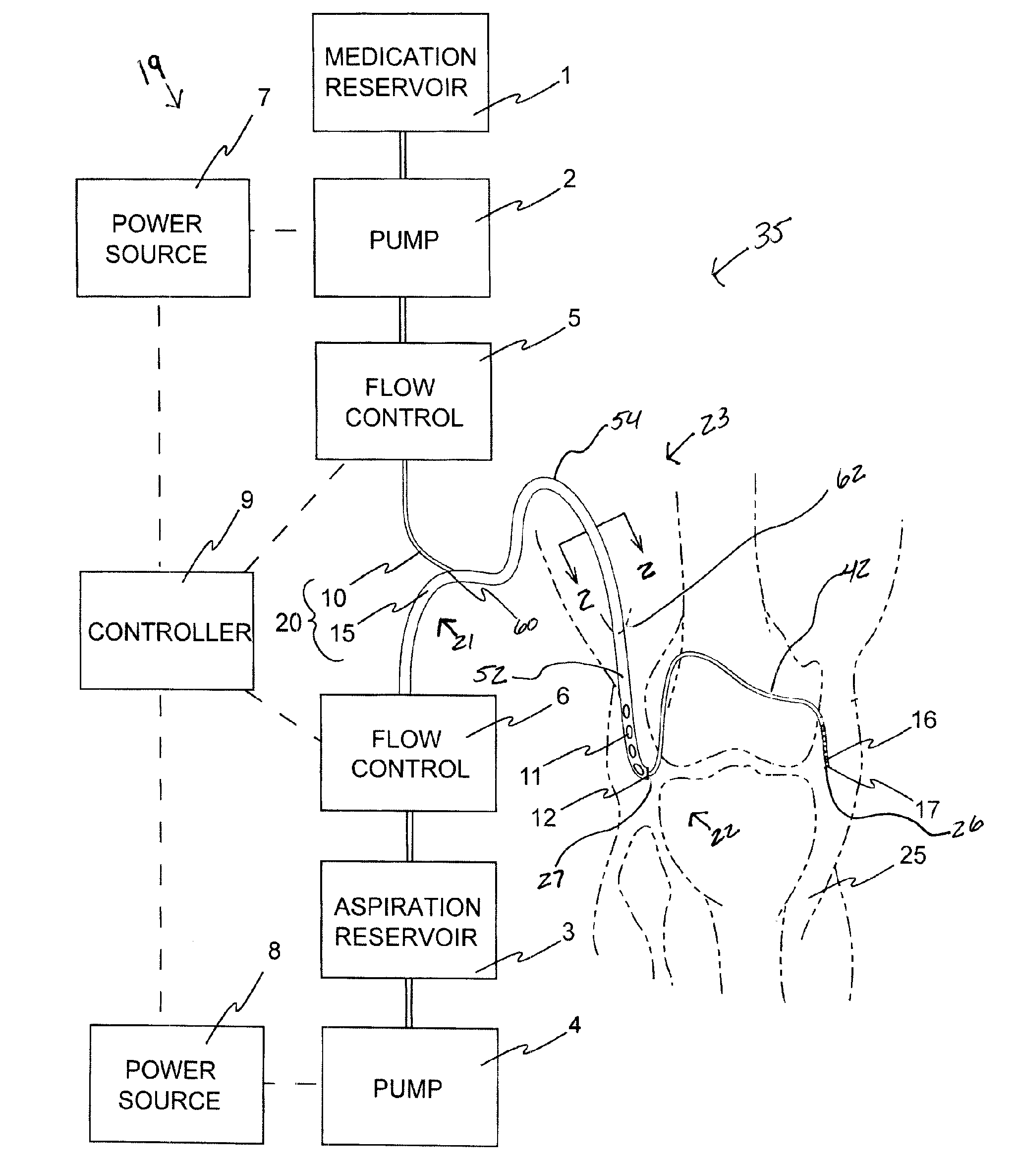 Integrated Infusion and Aspiration System and Method
