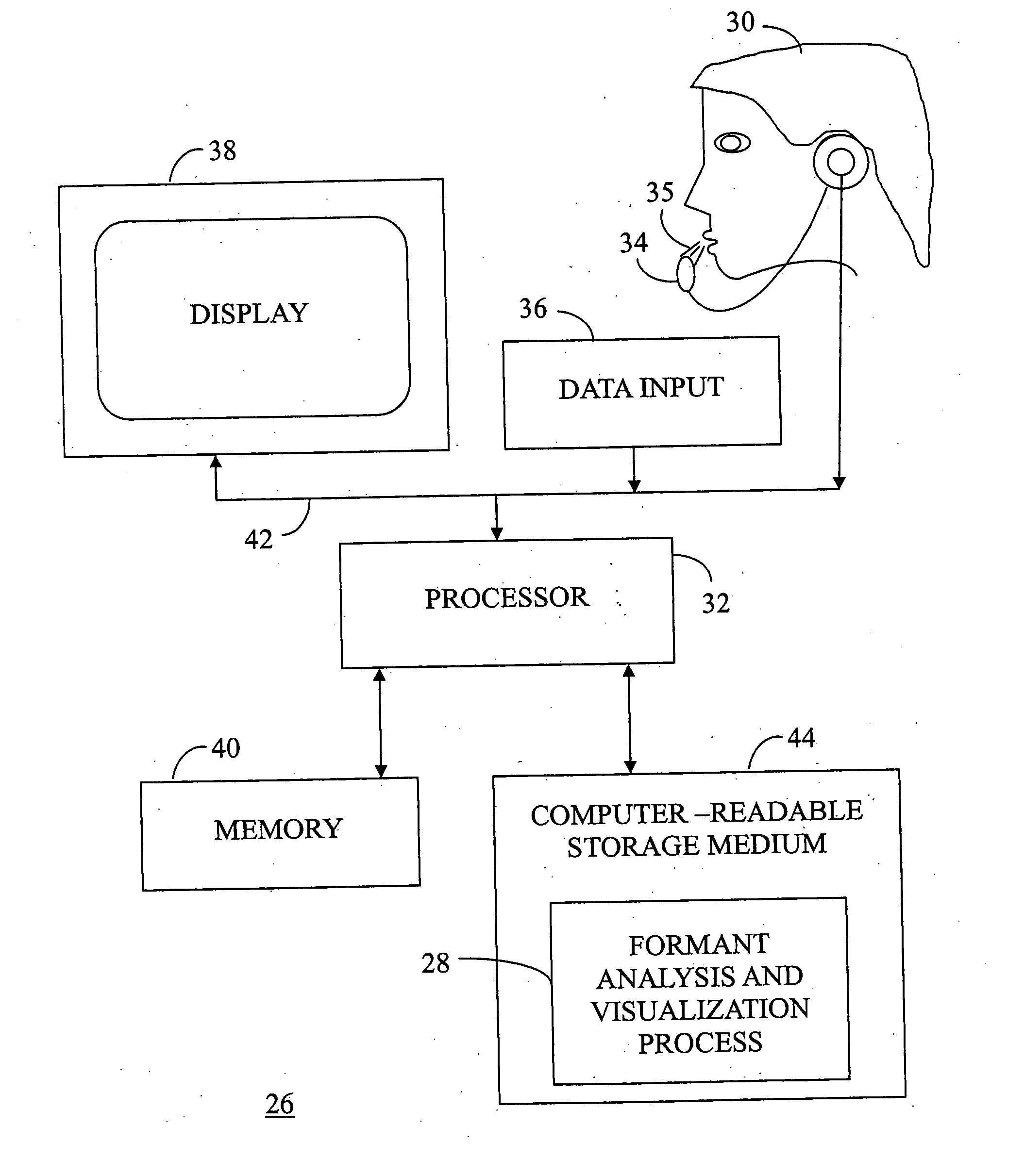 Real time voice analysis and method for providing speech therapy
