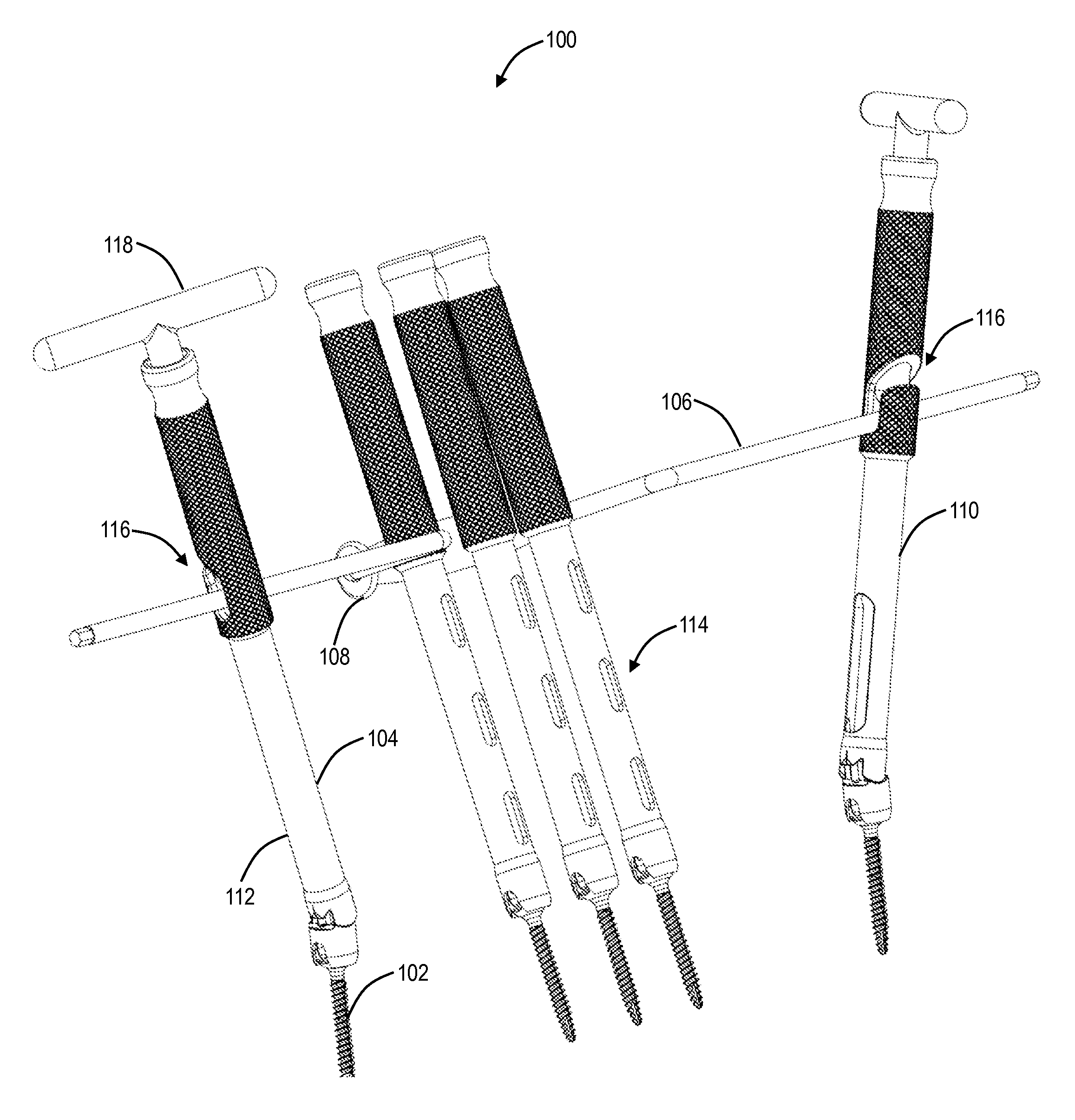 System and method for spinal deformity correction