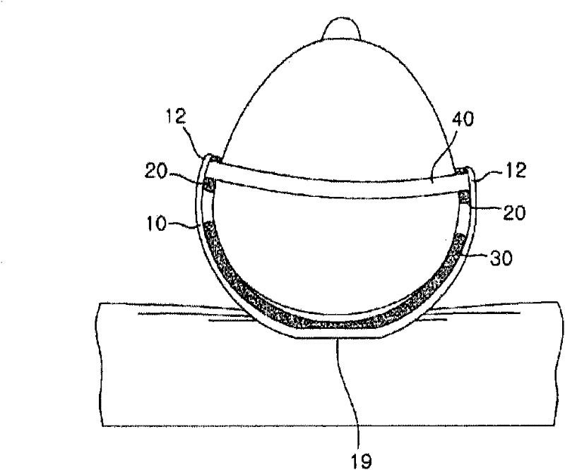 Head-shape remodelling instrument