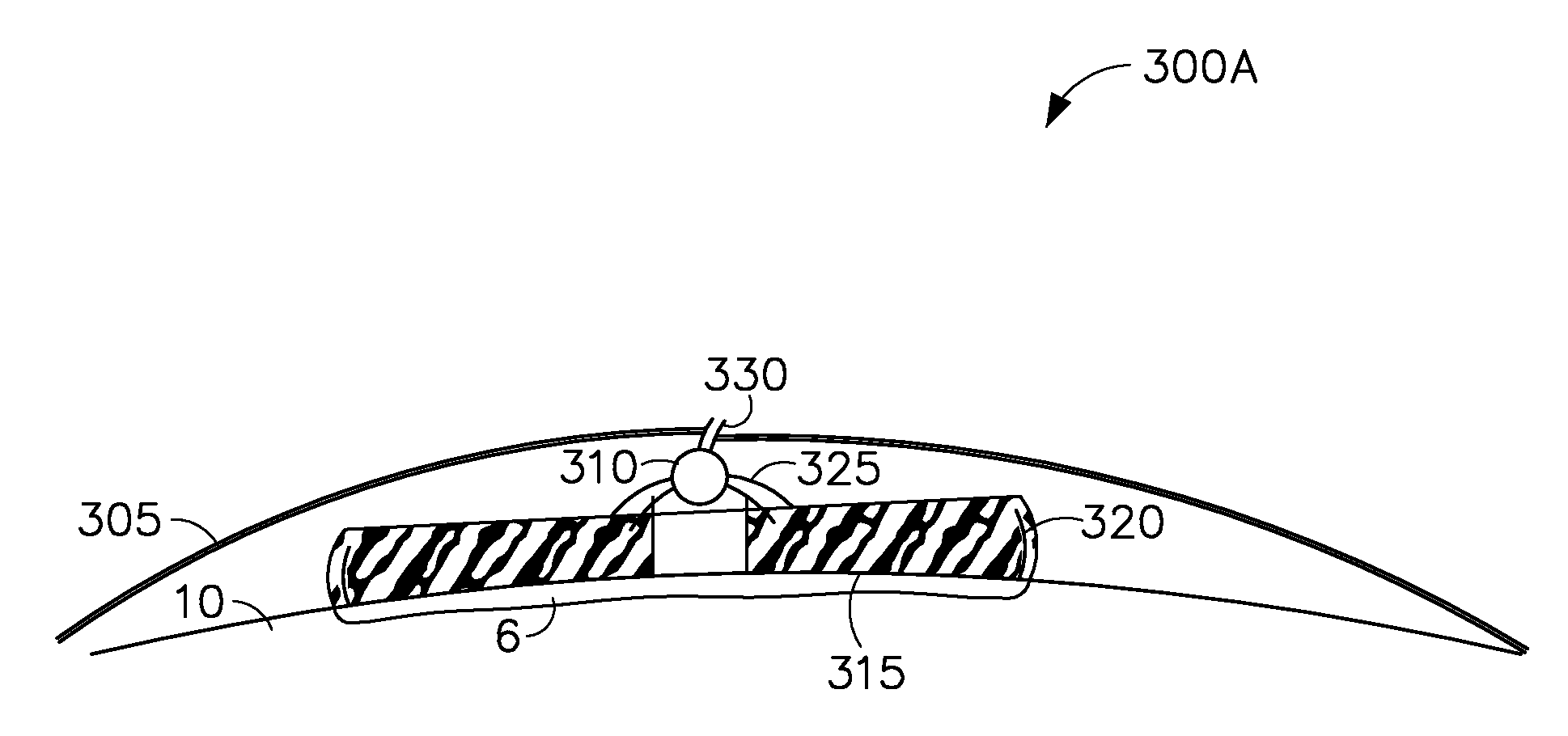 Methods and dressing systems for promoting healing of injured tissue