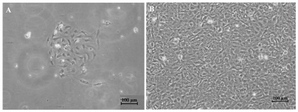 Rhabdovirus-sensitive monopterus albus kidney tissue cell line and application