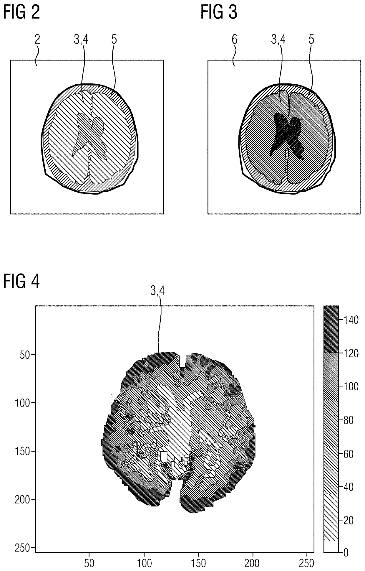 Method for automatically adapting an image data set obtained by an x-ray device