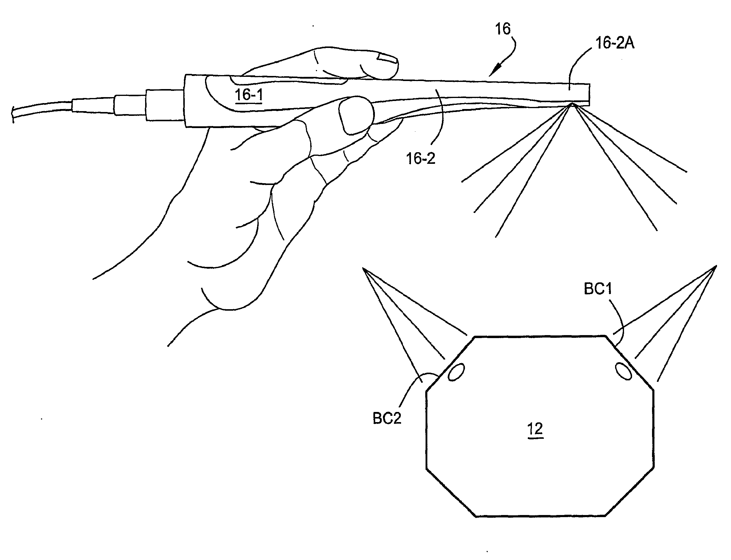 Force-responsive orthodontic brackets and systems and methods which use the same