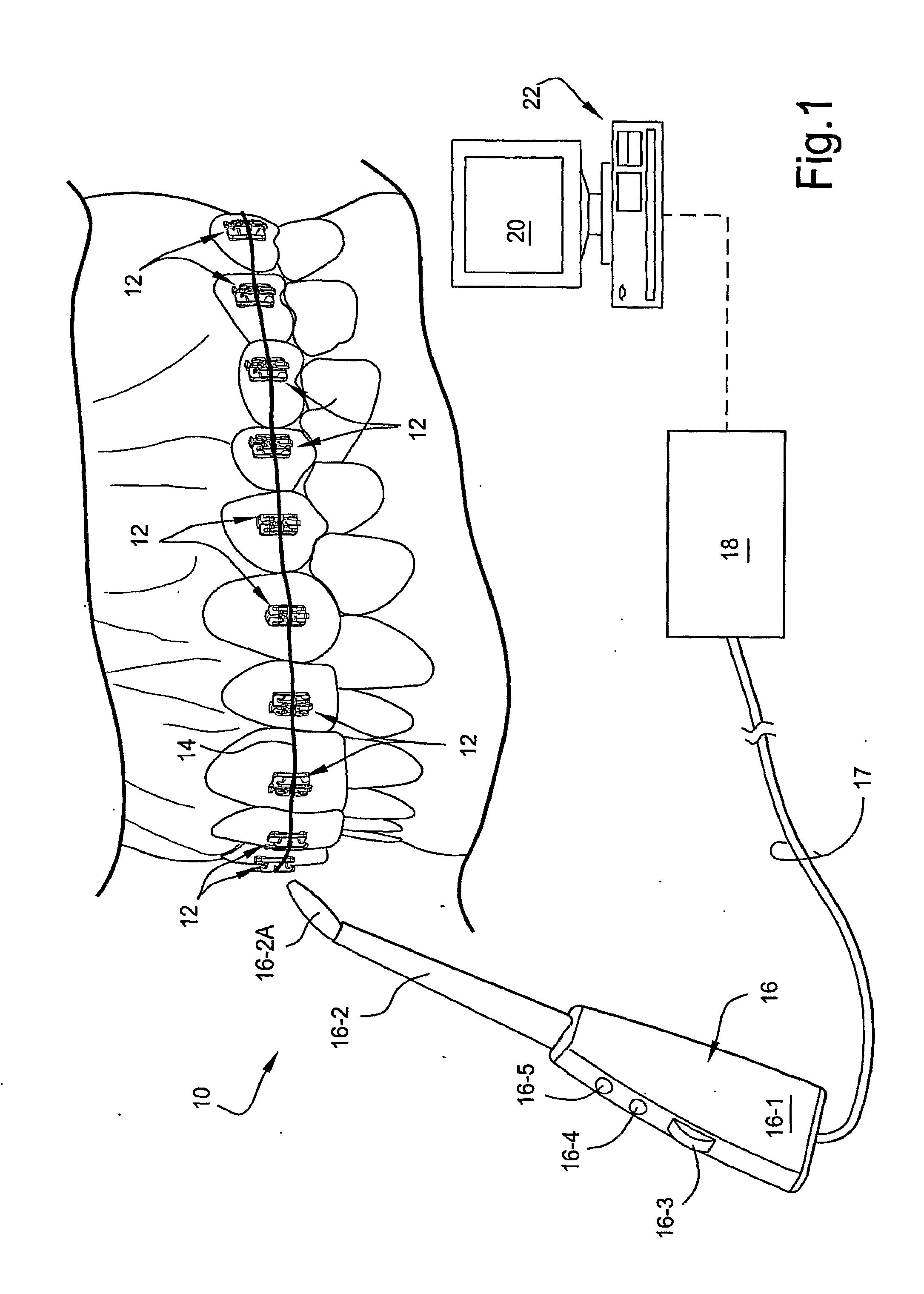 Force-responsive orthodontic brackets and systems and methods which use the same